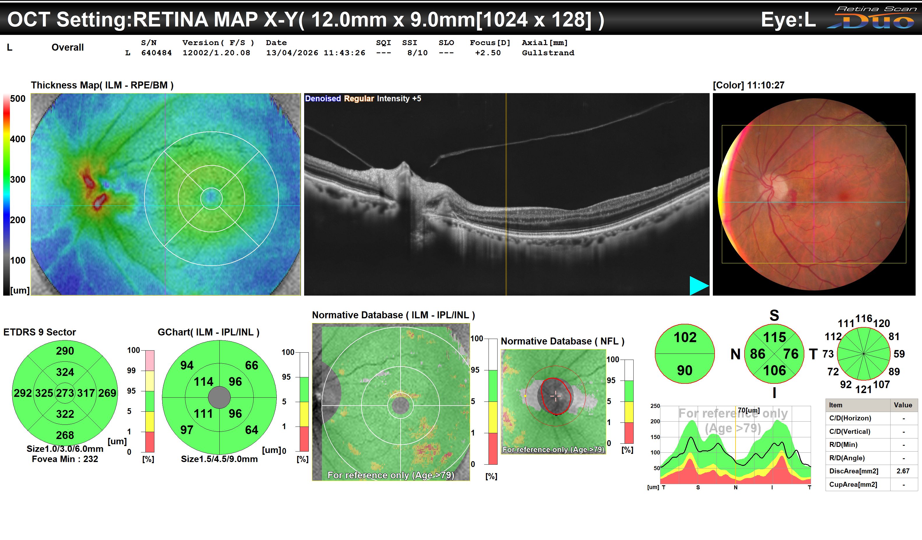 Colour fundus photograph, OCT and thickness map - left eye